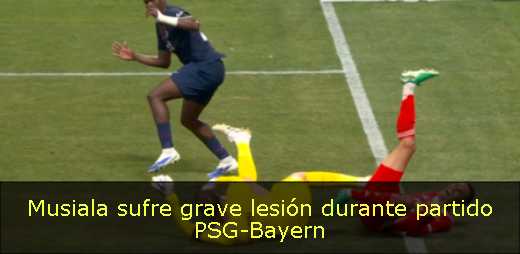 Musiala sufre grave lesión durante partido PSG-Bayern 