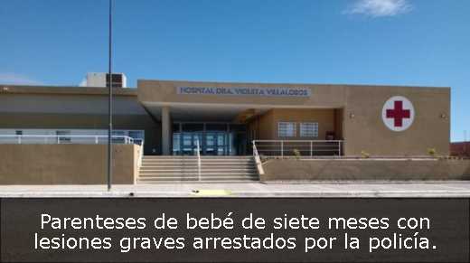 Parenteses de bebé de siete meses con lesiones graves arrestados por la policía