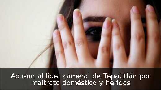 Acusan al líder cameral de Tepatitlán por maltrato doméstico y heridas 