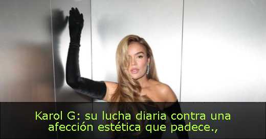 Karol G: su lucha diaria contra una afección estética que padece
