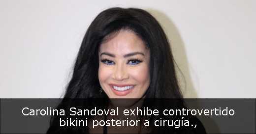 Carolina Sandoval exhibe controvertido bikini posterior a cirugía