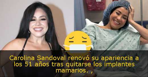 Carolina Sandoval renovó su apariencia a los 51 años tras quitarse los implantes mamarios. 